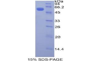 SDS-PAGE analysis of Human Plastin 3 Protein.