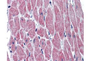 Immunohistochemistry (IHC) image for anti-Wingless-Type MMTV Integration Site Family, Member 10B (WNT10B) (AA 251-300) antibody (ABIN6747064)