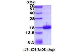Figure annotation denotes ug of protein loaded and % gel used. (TAC1 Protein)