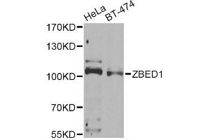 Western blot analysis of extracts of various cell lines, using ZBED1 Antibody (ABIN2560810) at 1:1000 dilution. (ZBED1 antibody)