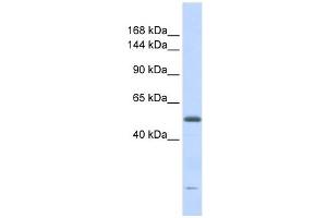 DNA2L antibody used at 1 ug/ml to detect target protein.