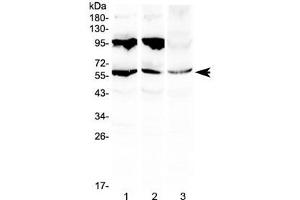 Western blot testing of 1) rat liver, 2) mouse liver and 3) human HepG2 lysate with PLIN1 antibody at 0. (PLIN1 antibody)