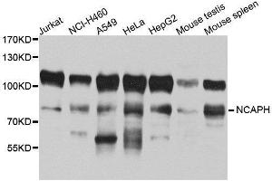 Western Blotting (WB) image for anti-Non-SMC Condensin I Complex, Subunit H (NCAPH) (AA 1-250) antibody (ABIN1680979) (NCAPH antibody  (AA 1-250))