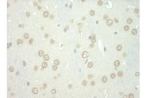 Immunohistochemistry (IHC) image for anti-WD Repeat and FYVE Domain Containing 3 (WDFY3) (AA 500-550) antibody (ABIN7453488)