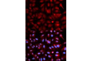 Immunofluorescence analysis of U2OS cells using PSMB5 antibody. (PSMB5 antibody)