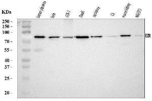 Western blot analysis of Ezrin/EZR using anti-Ezrin/EZR antibody (ABIN7603214).