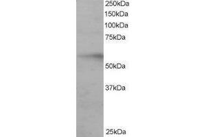 Western Blotting (WB) image for Interferon Regulatory Factor 6 (IRF6) peptide (ABIN369981) (Interferon Regulatory Factor 6 (IRF6) Peptide)