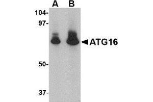 AP20063PU-N ATG16 antibody staining of HeLa Cell Lysate by Western Blotting at (A) 1 and (B) 2 μg/ml. (ATG16L1 antibody  (N-Term))