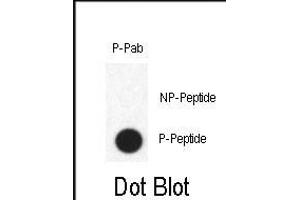 Dot blot analysis of anti-Phospho-FABP4-pY20 Antibody (ABIN390006 and ABIN2839779) on nitrocellulose membrane. (FABP4 antibody  (pTyr20))