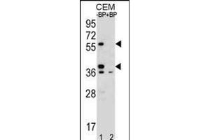Western blot analysis of MNDA Antibody (N-term) Pab (ABIN655190 and ABIN2844806) pre-incubated without(lane 1) and with(lane 2) blocking peptide in CEM cell line lysate.