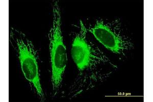 Immunofluorescence of purified MaxPab antibody to TOMM70A on HeLa cell. (TOM70 antibody  (AA 1-608))