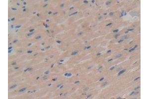 Immunohistochemistry (IHC) image for anti-serum/glucocorticoid Regulated Kinase 1 (SGK1) (AA 145-386) antibody (ABIN7443206)
