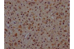 Immunohistochemistry (IHC) image for anti-Valosin Containing Protein (VCP) antibody (ABIN7127867)