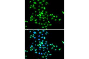Immunofluorescence analysis of MCF-7 cells using SBDS antibody. (SBDS antibody  (AA 1-250))