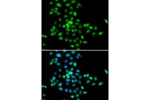 Immunofluorescence analysis of MCF-7 cells using SBDS antibody. (SBDS antibody  (AA 1-250))