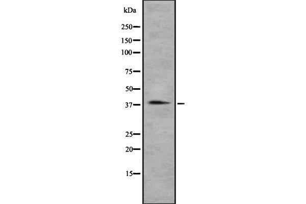 CCRL2 antibody  (Internal Region)