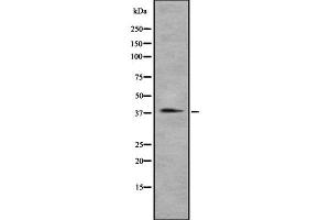 Western blot analysis of CCRL2 using A549 whole cell lysates