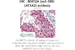 Image no. 2 for anti-Methionine Adenosyltransferase II, alpha (MAT2A) (AA 1-395) antibody (ABIN1724355)