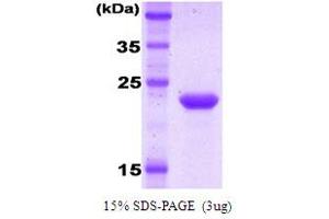 SDS-PAGE (SDS) image for Killer Cell Immunoglobulin-Like Receptor, Two Domains, Long Cytoplasmic Tail, 1 (KIR2DL1) protein (ABIN666833) (KIR2DL1 Protein)