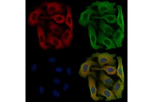 ABIN6258163 and ABIN6275958 staining Hela cells by IF/ICC.