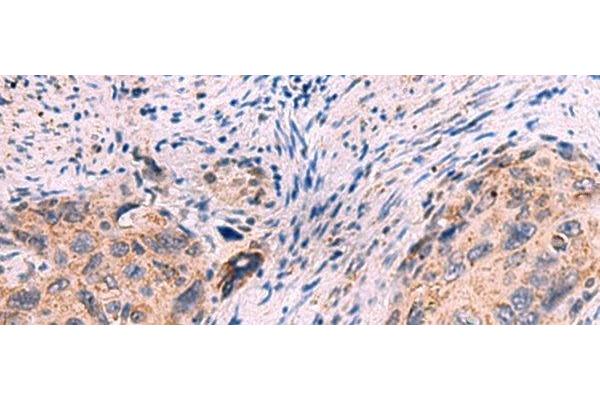 KCNN1 antibody