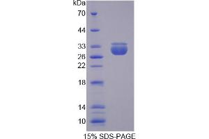 Image no. 1 for Transportin 2 (TNPO2) (AA 17-248) protein (His tag) (ABIN4989766) (TNPO2 Protein (AA 17-248) (His tag))