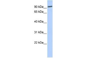 WB Suggested Anti-NOTCH2 Antibody Titration:  0.
