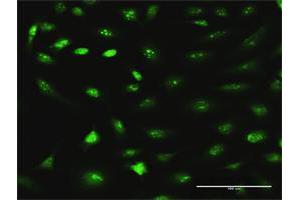 Immunofluorescence of purified MaxPab antibody to RRS1 on HeLa cell. (RRS1 antibody  (AA 1-365))