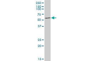 ARHGEF5 MaxPab rabbit polyclonal antibody. (ARHGEF5 antibody  (AA 1-519))