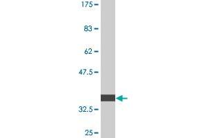 Western Blot detection against Immunogen (36. (PIK3R4 antibody  (AA 1259-1358))
