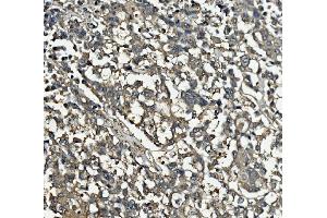 IHC analysis of Clathrin heavy chain/CLTC using anti-Clathrin heavy chain/CLTC antibody (ABIN7602703). (Clathrin Heavy Chain (CLTC) (AA 967-1668) antibody)