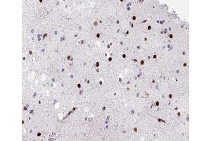 ABIN6266483 at 1/200 staining human brain tissue sections by IHC-P. (HNRNPD/AUF1 antibody  (Internal Region))