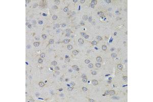 Immunohistochemistry of paraffin-embedded rat brain using AMPD1 antibody. (AMPD1 antibody)