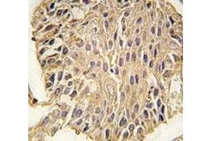 Immunohistochemistry (IHC) image for anti-Aldolase A, Fructose-Bisphosphate (ALDOA) (AA 303-331) antibody (ABIN3029902)