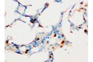 Immunohistochemical analysis of paraffin-embedded rat lung sections, stain SOCS1 in cytoplasm DAB chromogenic reaction. (SOCS1 antibody  (C-Term))