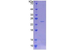 SDS-PAGE (SDS) image for Patatin-Like phospholipase Domain Containing 6 (PNPLA6) (AA 965-1137) protein (His tag) (ABIN6237211)