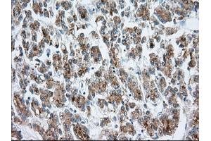 Immunohistochemistry (IHC) image for anti-Mitochondrial Translational Release Factor 1-Like (MTRF1L) antibody (ABIN1498695) (MTRF1L antibody)