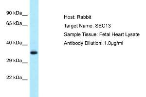 Host: Rabbit Target Name: SEC13 Sample Type: Fetal Heart lysates Antibody Dilution: 1. (SEC13 antibody  (C-Term))