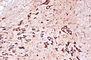 Immunohistochemistry of paraffin-embedded mouse spinal cord using PRKRA/PACTRabbit mAb (ABIN7269666) at dilution of 1:100 (40x lens). (PRKRA antibody)