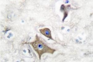 Image no. 2 for anti-Enolase 2 (Gamma, Neuronal) (ENO2) antibody (ABIN271752) (ENO2/NSE antibody)