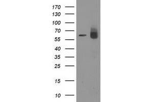 HEK293T cells were transfected with the pCMV6-ENTRY control (Left lane) or pCMV6-ENTRY ACOT12 (Right lane) cDNA for 48 hrs and lysed. (ACOT12 antibody)