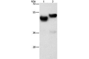 Western Blot analysis of Human fetal brain and liver tissue using AMZ1 Polyclonal Antibody at dilution of 1:1000 (AMZ1 antibody)