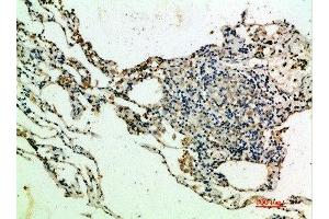 Immunohistochemical analysis of paraffin-embedded human-lung, antibody was diluted at 1:200 (THBS4 antibody  (AA 551-600))