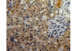 Used in DAB staining on fromalin fixed paraffin-embedded Kidney tissue (PGC antibody  (AA 17-392))