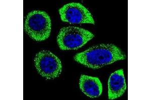 Immunofluorescence (IF) image for anti-Phosphatidylinositol-4-Phosphate 5-Kinase-Like 1 (PIP5KL1) antibody (ABIN2996126) (PIP5KL1 antibody)