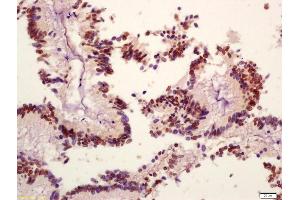 Immunohistochemistry (IHC) image for anti-Phosphoinositide-3-Kinase, Catalytic, beta Polypeptide (PIK3CB) (pSer1070) antibody (ABIN872304)