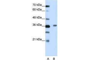 Western Blotting (WB) image for anti-BTB (POZ) Domain Containing 6 (BTBD6) antibody (ABIN2461967)