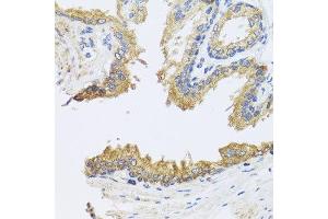 Immunohistochemistry of paraffin-embedded human prostate using ARL6 antibody at dilution of 1:100 (x40 lens). (ARL6 antibody)