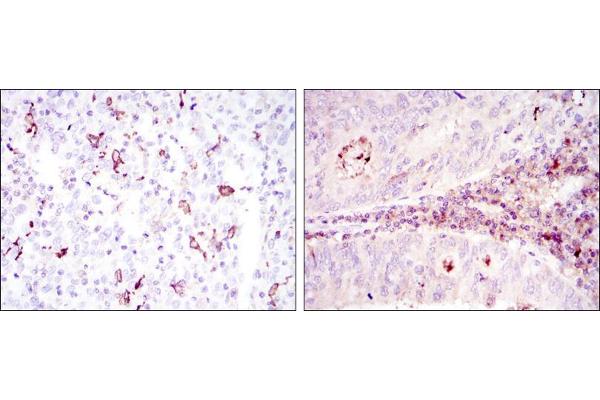 CD1a antibody