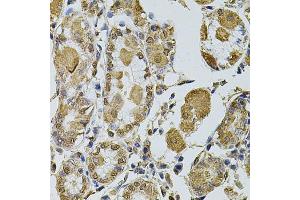 Immunohistochemistry of paraffin-embedded human stomach using CCNA2 antibody (ABIN1871532) at dilution of 1:100 (40x lens). (Cyclin A antibody)